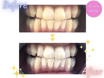 エクシアホワイト 長野店/