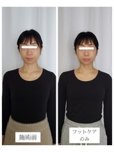 エクラ(eclat)/お客様の変換（正面）