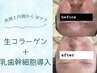 【NEWメニュー☆誕生】生コラーゲン×幹細胞導入！溢れ出るハリ艶肌へ♪