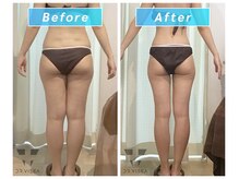 エムプラス(Mplus.)の雰囲気(ラジオ波/キャビテーション/吸引などを駆使し痩せやすい体に!!)