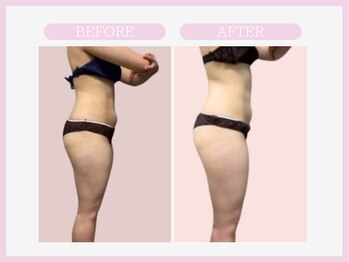 スリムライン 青森店(The Slim Line)/before→after