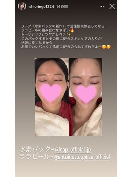 エステティック アントワネット/