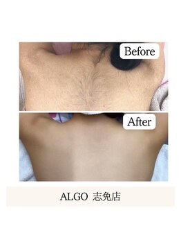 アルゴ 志免店(ALGO)/スクラブでツルスベ肌♪