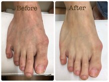 カーニバルマニア 三田店(Carnival Mania)/育爪フットケア＆足甲エステ