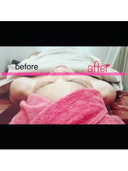 アニー(Annie)/毛穴!乾燥!むくみ!肩首こり!