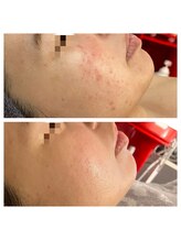 エリー(ERIE)/3ヶ月の変化