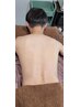 8月men's大歓迎　背中全体脱毛　¥10000→¥7000円
