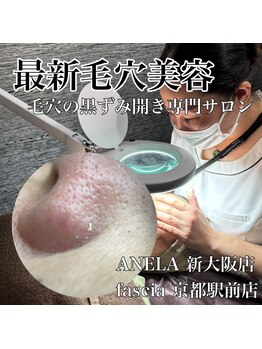 アネラ(ANELA)/毛穴エクストラクション症例.2