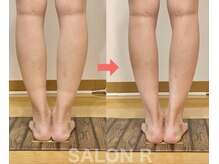 サロンアール(SALON R)/ふくらはぎシュッと♪足首キレイ
