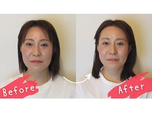 小顔 美容整体サロン ハチ( HACHI)の雰囲気（ゆがみが整うと同時に小顔になり、むくみ解消で痩せて見える！）
