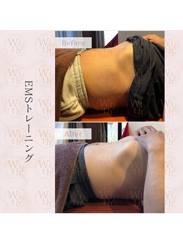 うぃず鍼灸整骨院/【施術例２】