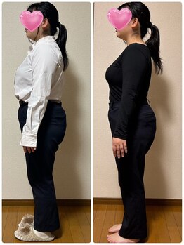 ベルネージュ 千葉山王店(Belle Neige)/【耳つぼ】20代1ヶ月-4.9kg