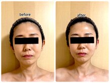 ラディアントミューズ(RadiantMuse)の雰囲気（小顔矯正でキュッと小顔(造形小顔スリム)）