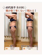 ユナリ(yunari)/40代後半｜Before・Afte…２