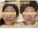 ロータス(LOTUS)の写真