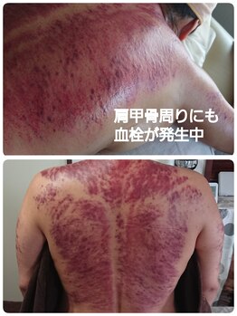 オアシス(OASIS)/デトックスかっさ