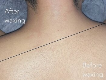 ワクシー 麻布十番店(WAXYYY.)/【ワックス脱毛】
