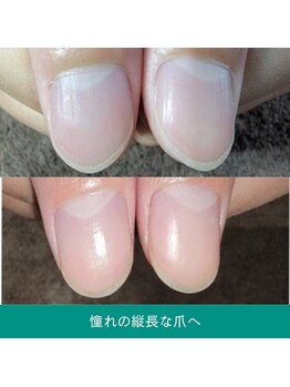 地爪ケアクリニックサロン 仙台/【超本格ハンドケア】