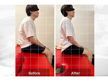 ナオル整体 浦添院(NAORU整体)/沖縄県/浦添/肩こり/整体/腰痛