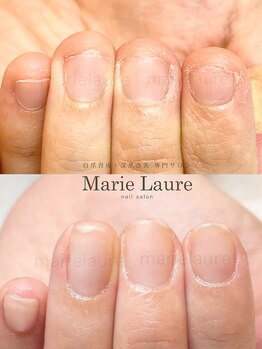 マリーロール 淀屋橋本店(Marie Laure)/自爪育成/深爪矯正/ネイルケア