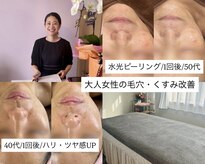 ルチルス(Rutiles)