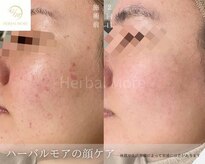 サロンド ベレーゼ