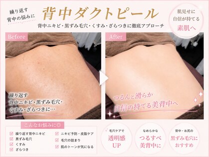 ルミブラン(Lumi Blanc)の写真