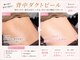ルミブラン(Lumi Blanc)の写真