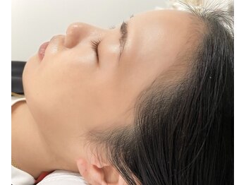 フィズアイビューティー 岡崎竜美ヶ丘店(fiz eye beauty)の写真/【美肌×垢抜け】ツヤっと輝く透明感!余分な産毛、角質オフでメイクのり劇的アップ。全顔フェイスワックス