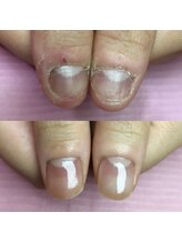 イリスネイル(IRIS NAIL)/