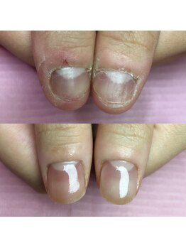 イリスネイル(IRIS NAIL)/