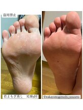 イチハチドット(18.)/足湯の草