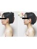 小顔形成×フェイシャル(ヒト幹細胞配合)