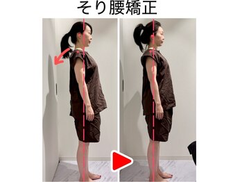 エレヴィザ トウキョウ 恵比寿院(ELVISA TOKYO)/そり腰・骨盤改善 / 初回施術