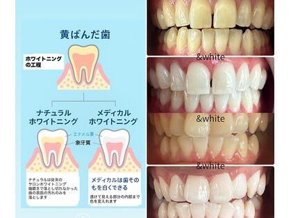 アンドホワイト 八日市店(&white)の写真