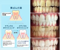 アンドホワイト 八日市店(&white)