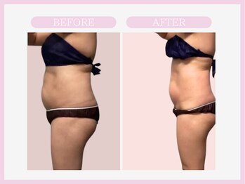 スリムライン 青森店(The Slim Line)/before→after