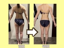 ビオール 新宿店(beall)/大人気！オーダーメイド痩身90分