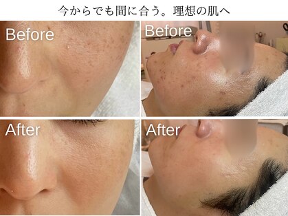 ハナコ 下通店(HANAKO)の写真