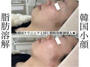 リベルキョウト 京都駅前店(Liber Kyoto)/レモンボトル超え!二重顎撃退