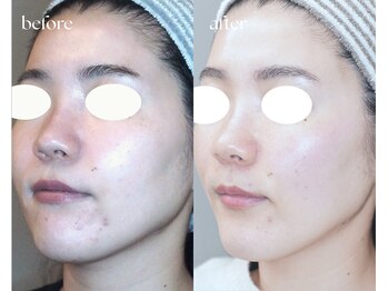 岩川治療院/施術3回