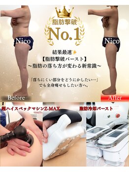 ニコ 岐南本店(Nico)の写真/結果最速！【脂肪撃破バースト】脂肪の落ち方が変わる新常識2回体験￥19800～