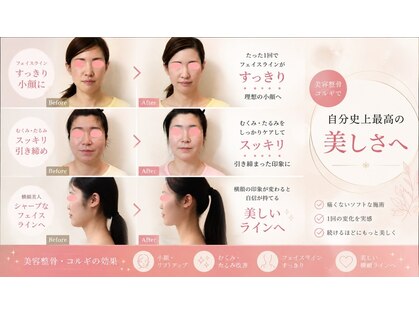 ローズ ド ナチュール(Rose de Nature)の写真