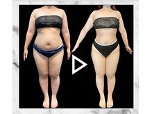 エステティック エイチアンドビー 大和店(H&B)/ビフォーアフター