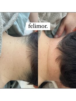 フェリモール(Felimor.)/シュガーリングbefore／after