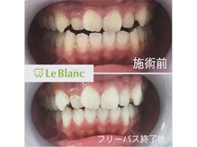 ルブラン 奈良店(Le Blanc)/明るい印象に！