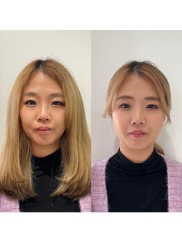 パーソナルサンフラワー(PersonalSunflower)/お客様ヘアメイクBefore/After