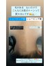 【学割U24】世界最新脱毛で自信が持てる肌に(お好きな箇所3箇所)¥5000→