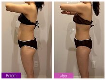 クレヴィア バイ サイバーエステ(CREBIA)/【ボディ120分回数券】全身痩せ