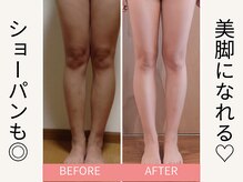 ヨサパーク ビーチ 花畑店(YOSA PARK BEACH)/ルルオンで美脚に！！